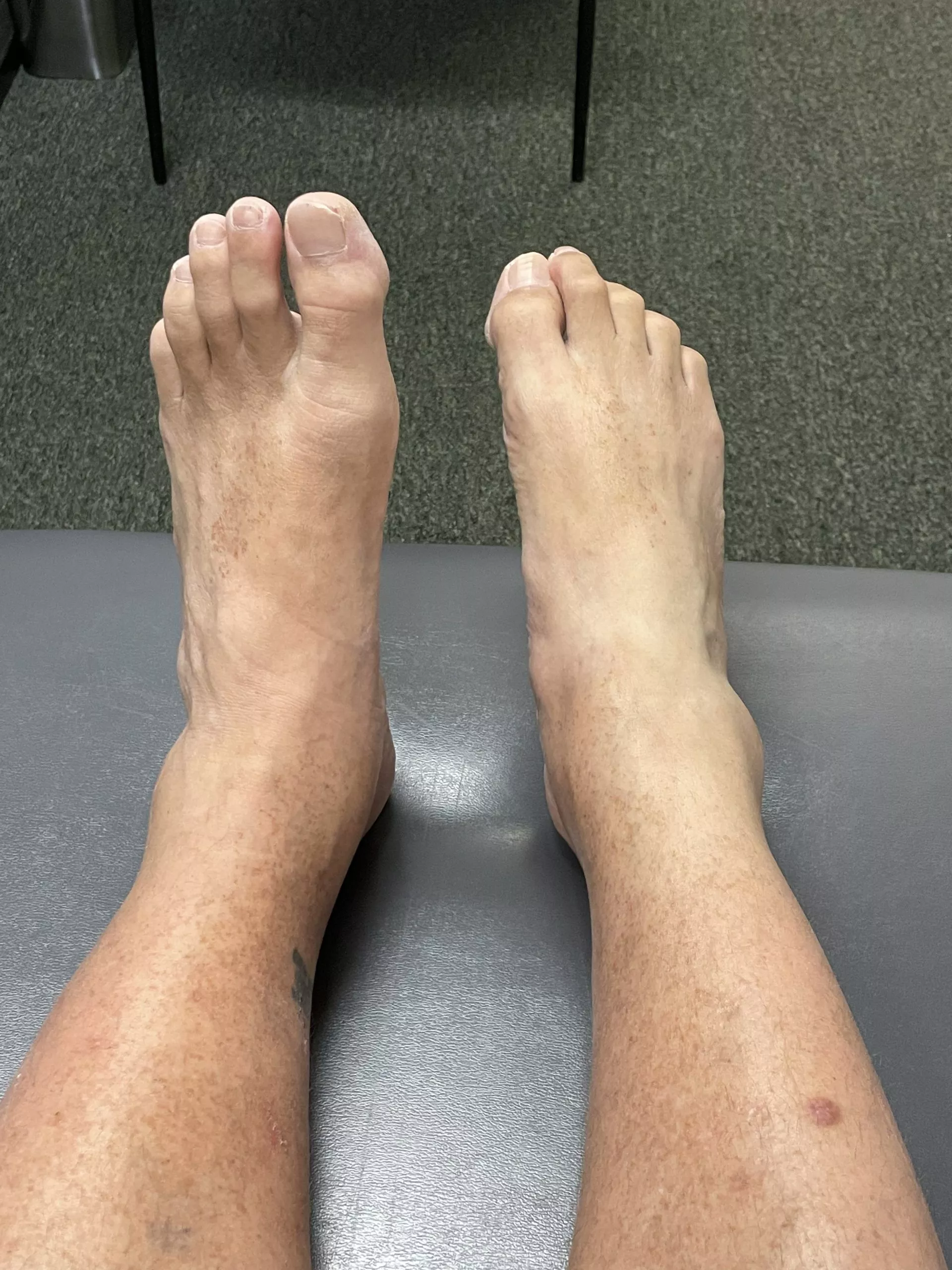 Neurological Physical Therapy