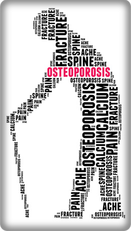 Physical Therapy for Osteoporosis