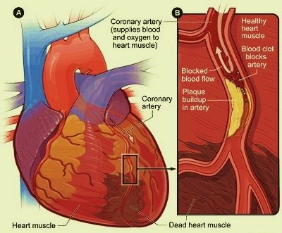 How to Take Care of your Heart